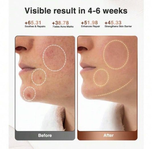 Red Light Therapy Face Mask with Near-Infrared – Rechargeable 4-Mode LED Skincare Device for Anti-Aging & Home Use